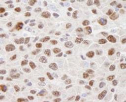 Detection of mouse hnRNP-U by immunohistochemistry.