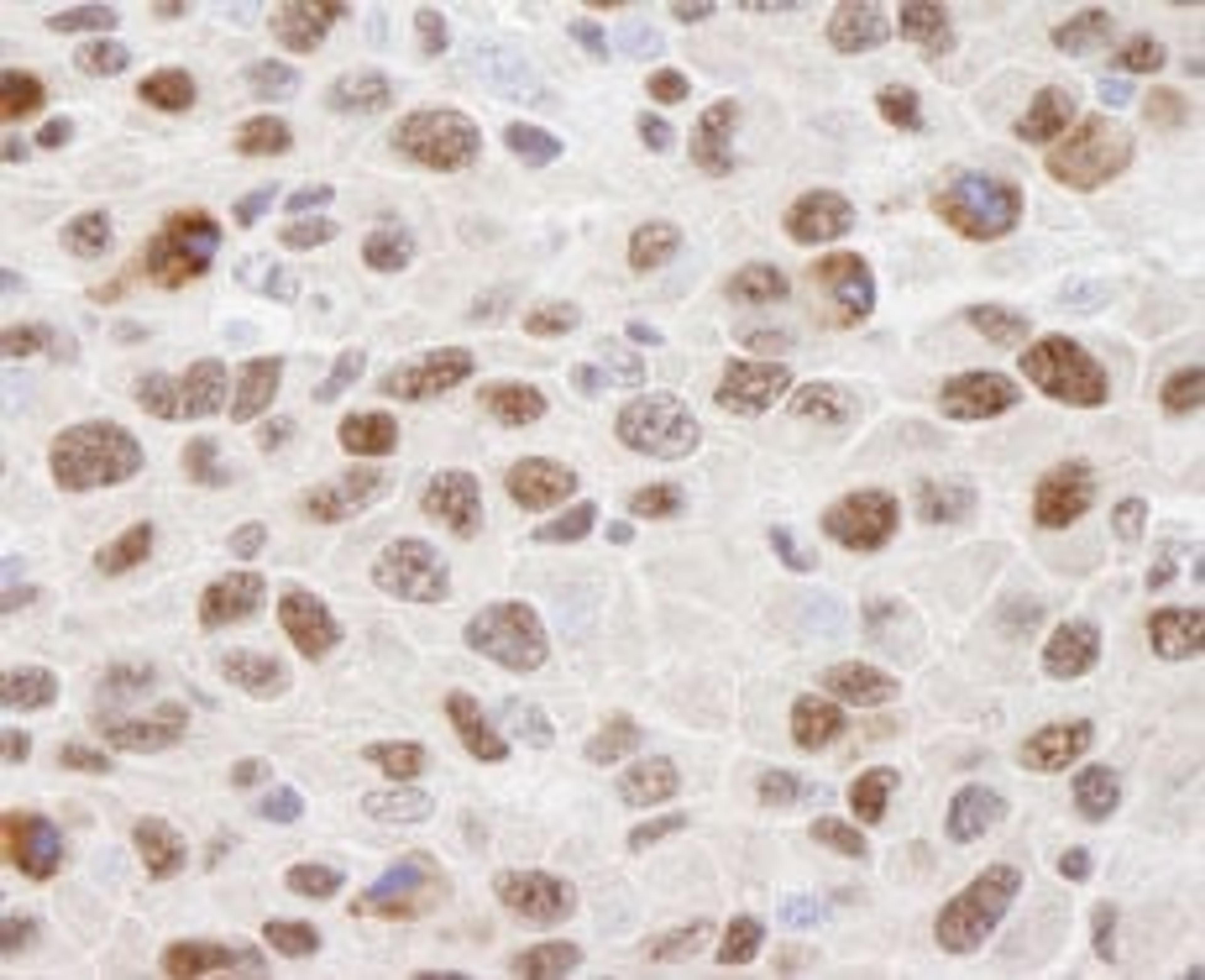 Detection of mouse hnRNP-U by immunohistochemistry.