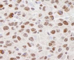 Detection of mouse hnRNP-U by immunohistochemistry.
