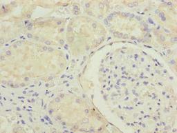 Immunohistochemistry of paraffin-embedded human kidney tissue using CSB-PA620882LA01HU at dilution of 1:100