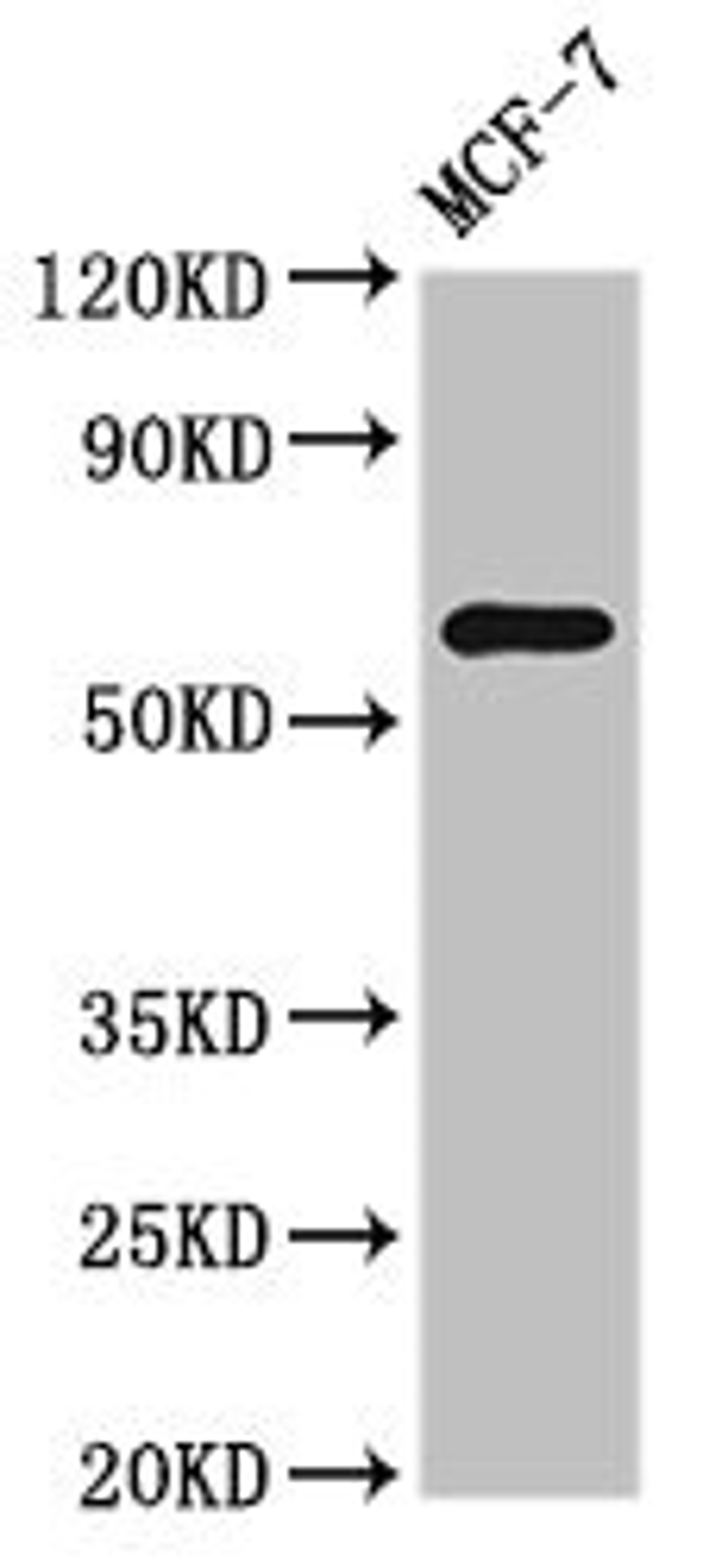 Western Blot. Positive WB detected in: MCF-7 whole cell lysate. All lanes: NR1D2 antibody at 3ug/ml. Secondary. Goat polyclonal to rabbit IgG at 1/50000 dilution. Predicted band size: 65 kDa. Observed band size: 65 kDa. 