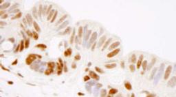 Detection of human GTF2I/TFII-I by immunohistochemistry.