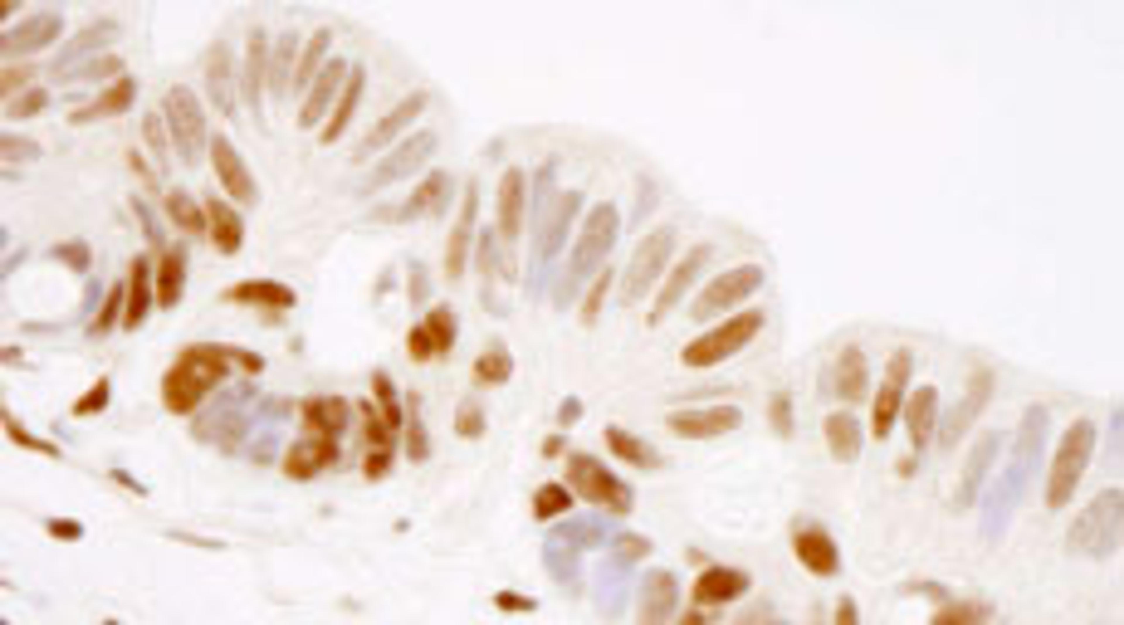 Detection of human GTF2I/TFII-I by immunohistochemistry.