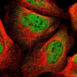 Immunocytochemistry/Immunofluorescence: RBM3 Antibody [NBP1-81580] - Staining of human cell line U-2 OS shows positivity in nucleus but not nucleoli.