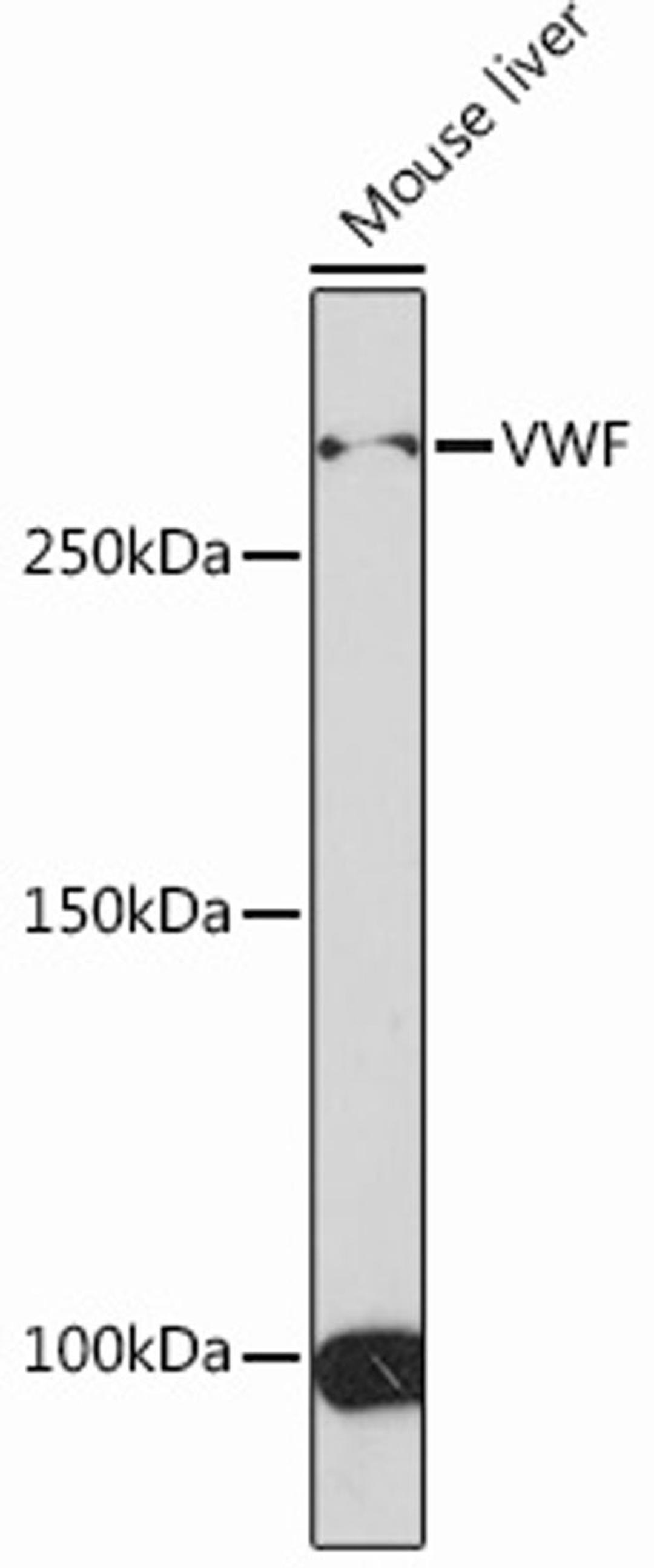 Western blot - VWF Rabbit mAb (A13523)