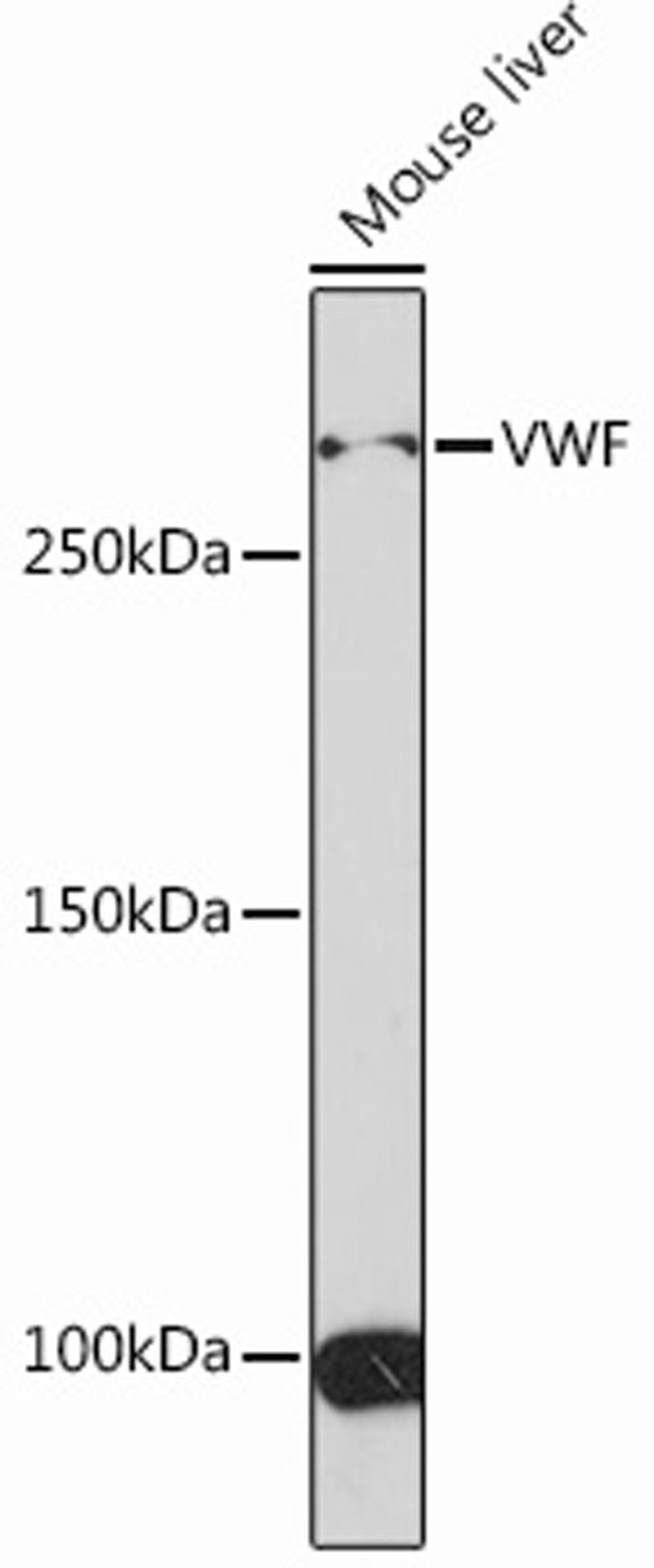 Western blot - VWF Rabbit mAb (A13523)