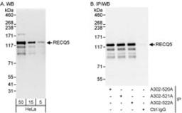 Detection of human RECQ5 by western blot and immunoprecipitation.