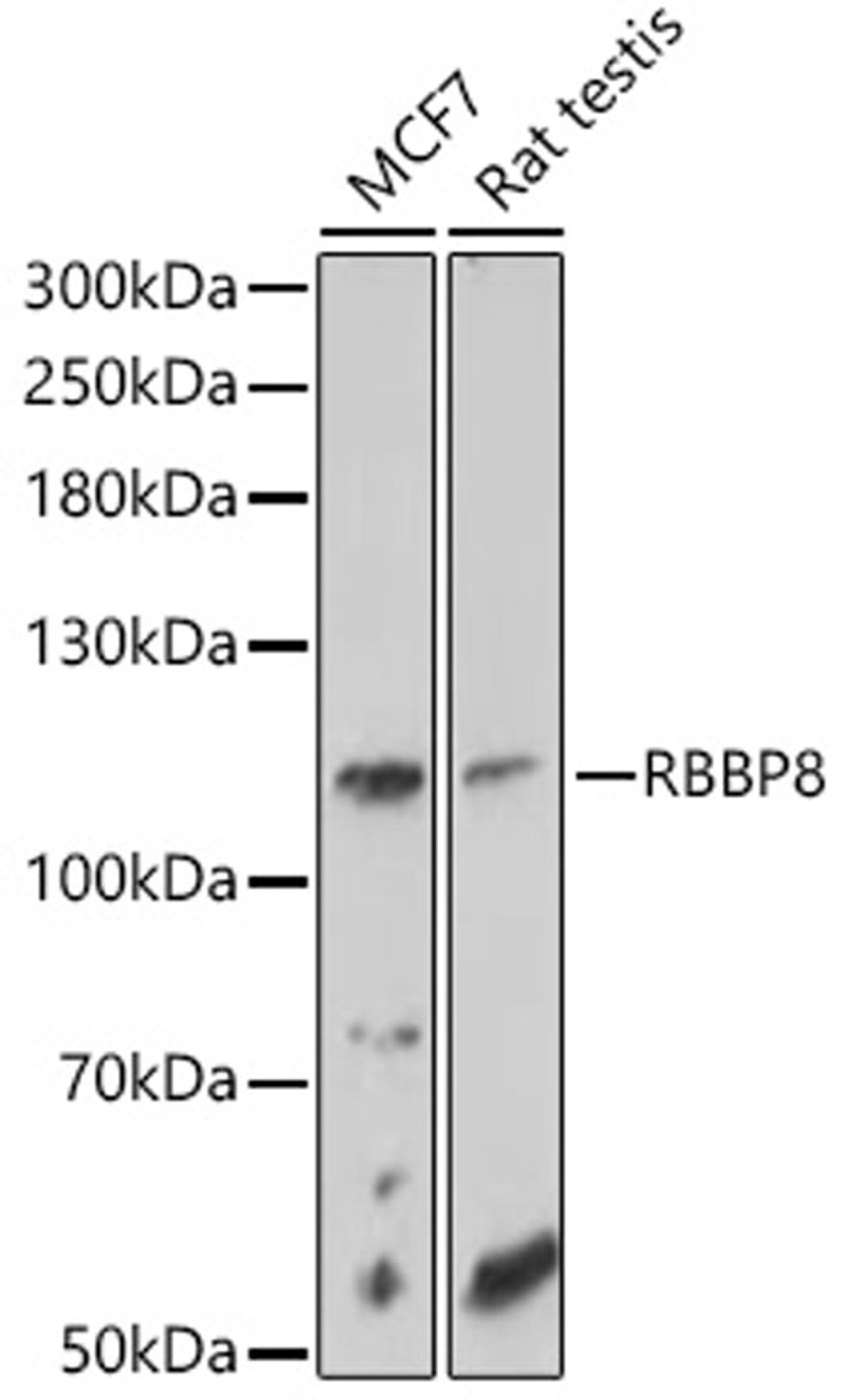 Western blot - RBBP8 antibody (A10201)