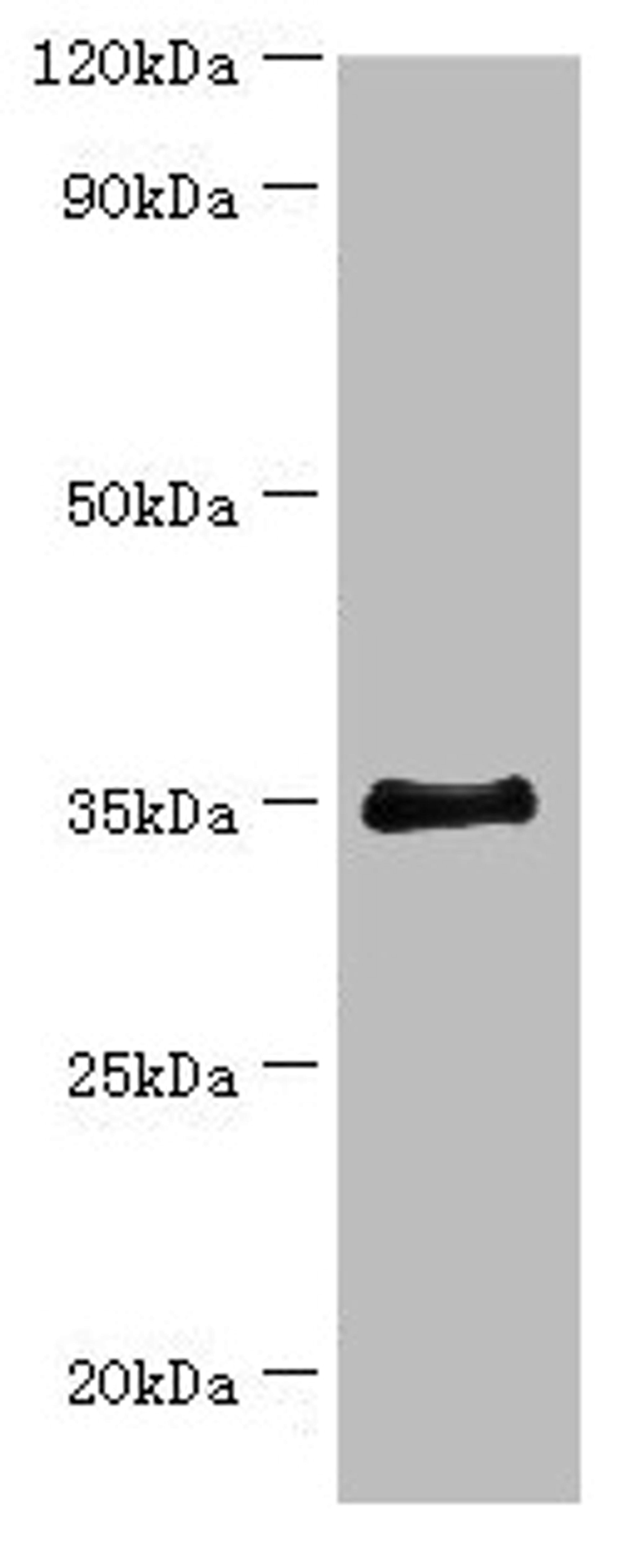 Western blot. All lanes: BCAT2 antibody at 14µg/ml + 293T whole cell lysate. Secondary. Goat polyclonal to rabbit IgG at 1/10000 dilution. Predicted band size: 45, 34 kDa. Observed band size: 34 kDa