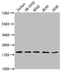 Western Blot. Positive WB detected in: Jurkat whole cell lysate, SH-SY5Y whole cell lysate, K562 whole cell lysate, HL-60 whole cell lysate, A549 whole cell lysate. All lanes: RPL24 antibody at 1:2000. Secondary. Goat polyclonal to rabbit IgG at 1/50000 dilution. Predicted band size: 18 kDa. Observed band size: 18 kDa. 
