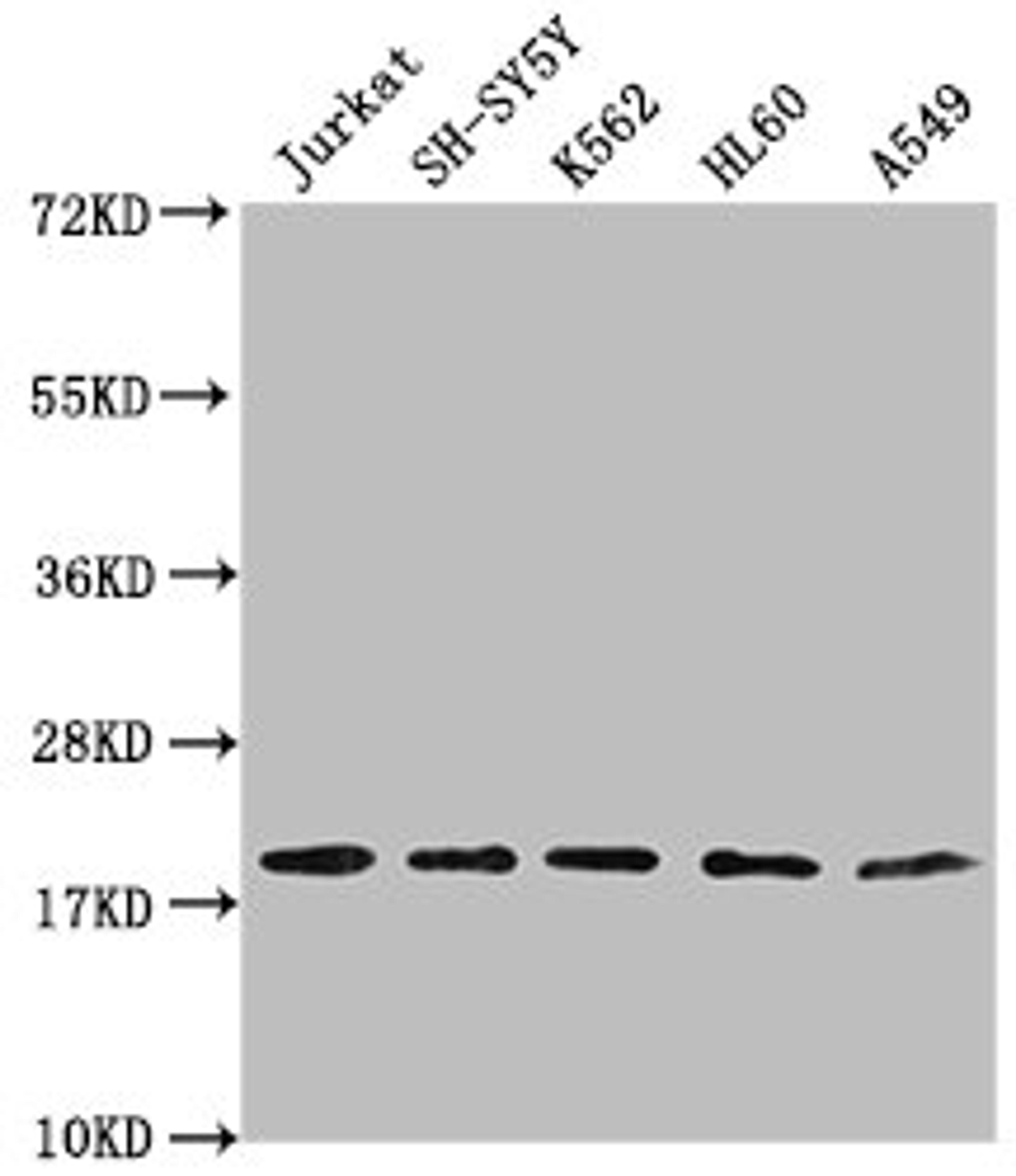 Western Blot. Positive WB detected in: Jurkat whole cell lysate, SH-SY5Y whole cell lysate, K562 whole cell lysate, HL-60 whole cell lysate, A549 whole cell lysate. All lanes: RPL24 antibody at 1:2000. Secondary. Goat polyclonal to rabbit IgG at 1/50000 dilution. Predicted band size: 18 kDa. Observed band size: 18 kDa. 