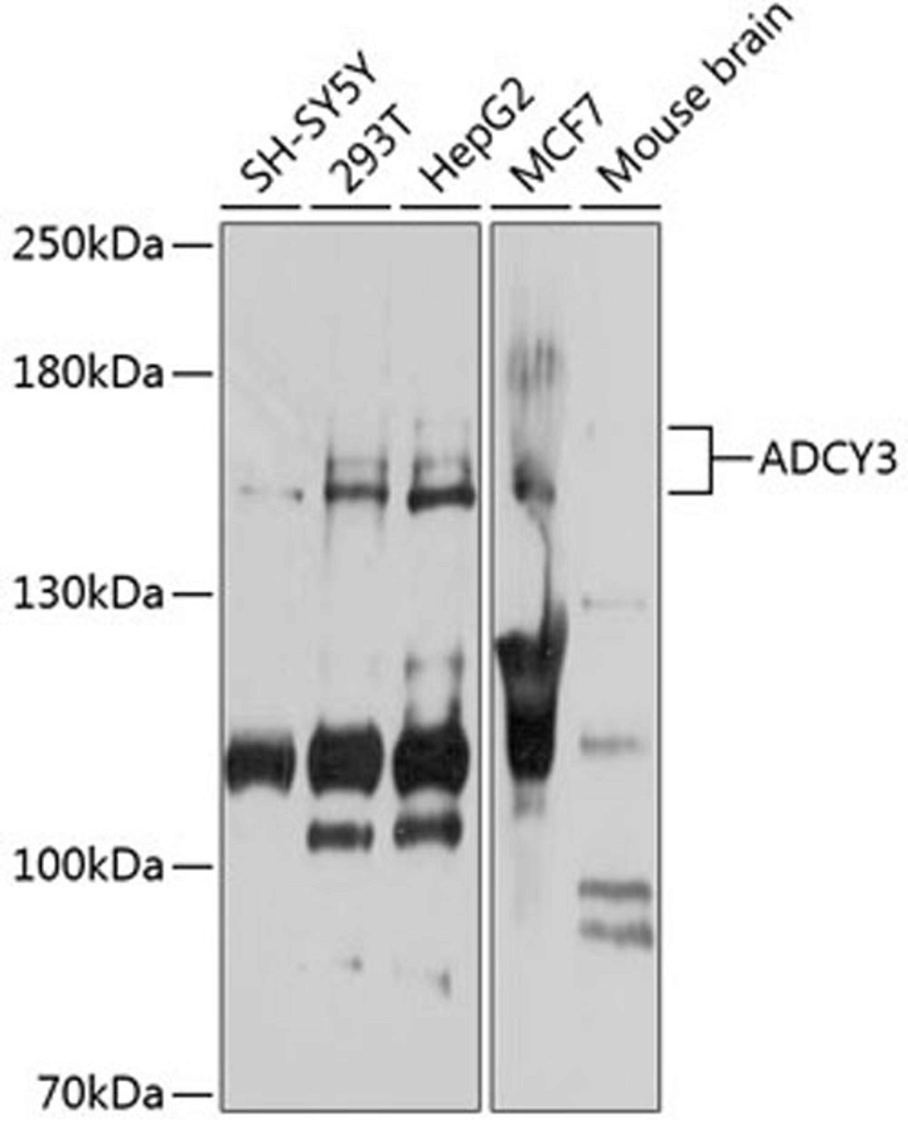 Western blot - ADCY3 antibody (A7870)