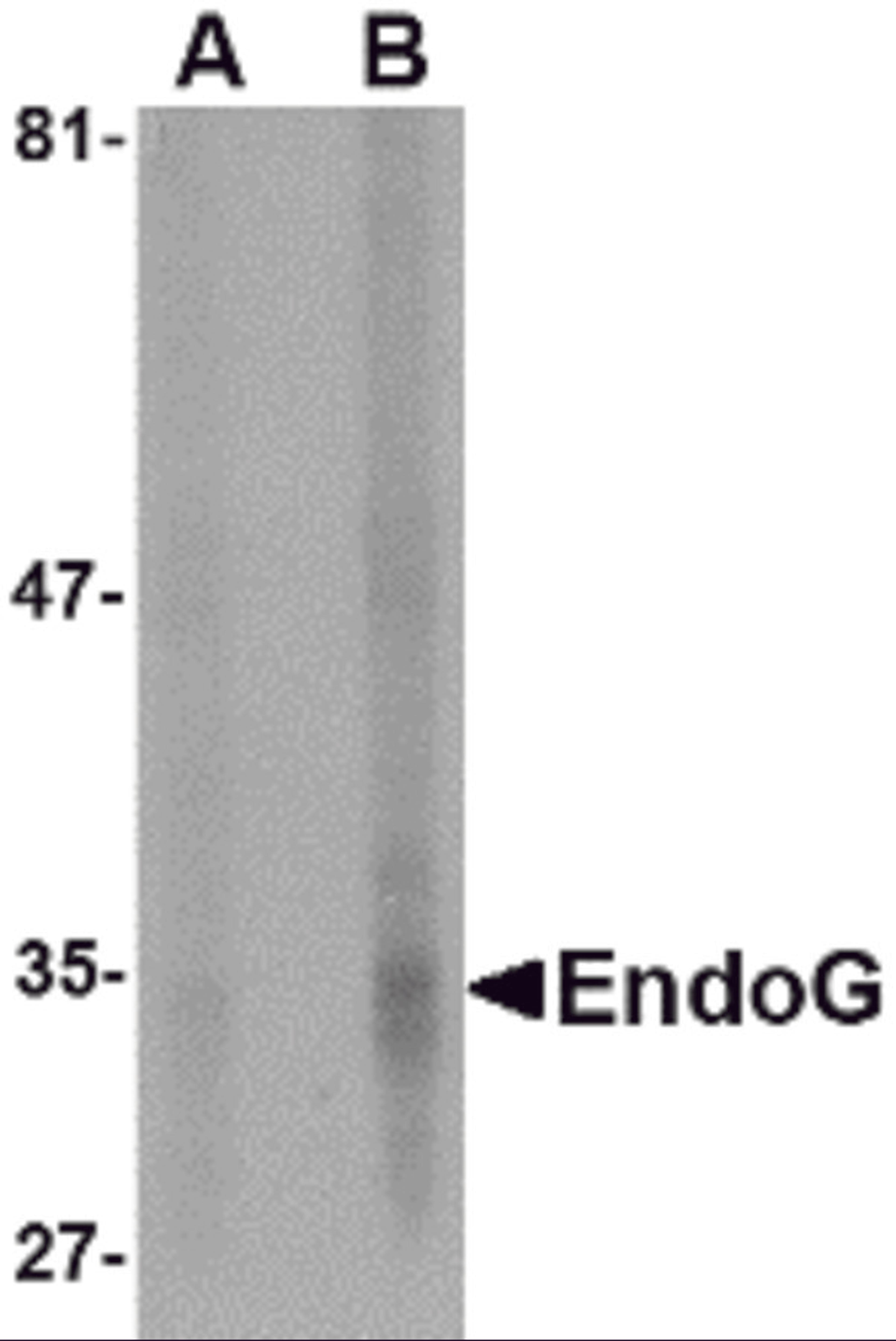 Western blot analysis of EndoG expression in HepG2 cell lysate with EndoG antibody at (A) 5 and (B) 10 &#956;g/mL.