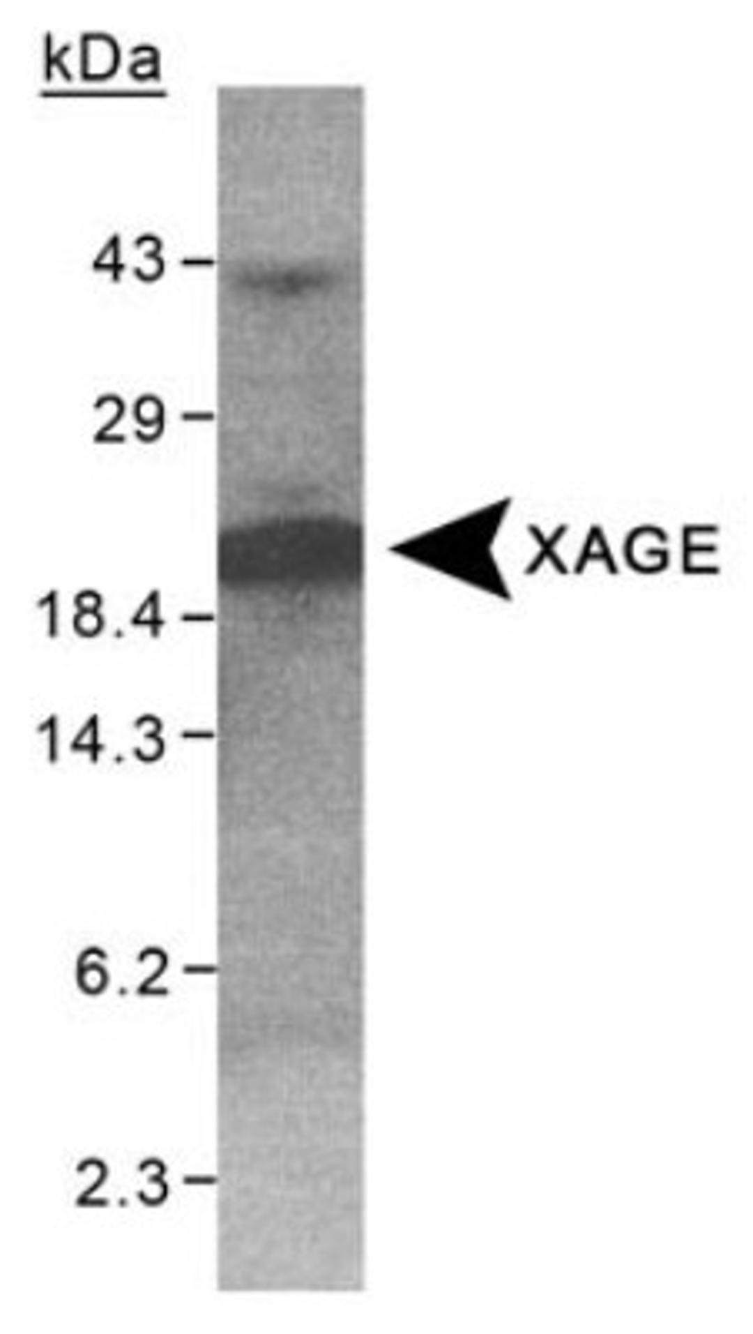 Western Blot: XAGE1 Antibody [NB100-262] - Detection of XAGE on purified His-XAGE (100 ug) using NB100-262.