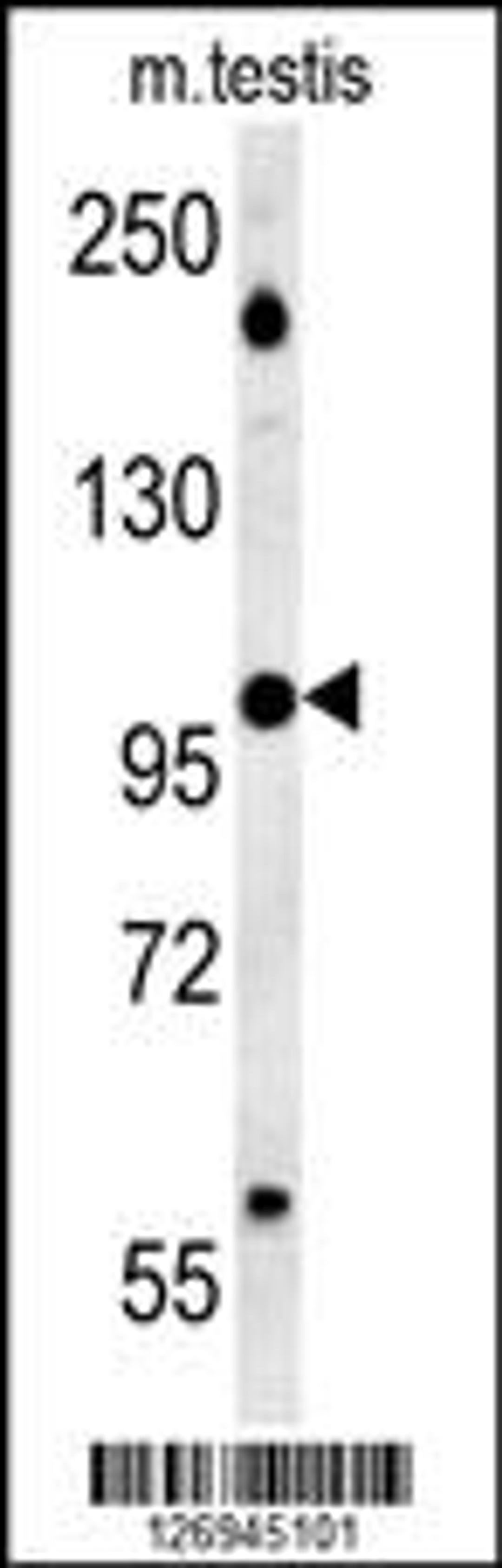 Western blot analysis in mouse testis tissue lysates (15ug/lane).This demonstrates the detected BRWD2 protein (arrow).