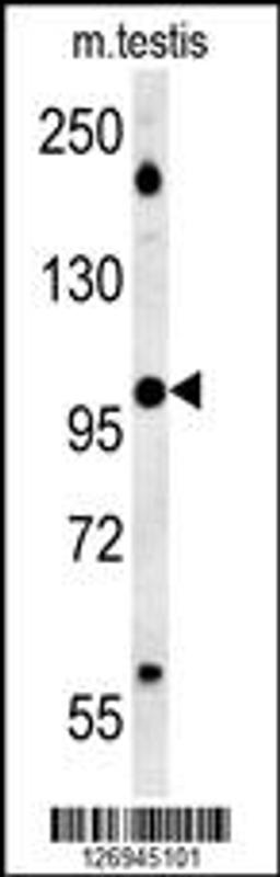 Western blot analysis in mouse testis tissue lysates (15ug/lane).This demonstrates the detected BRWD2 protein (arrow).