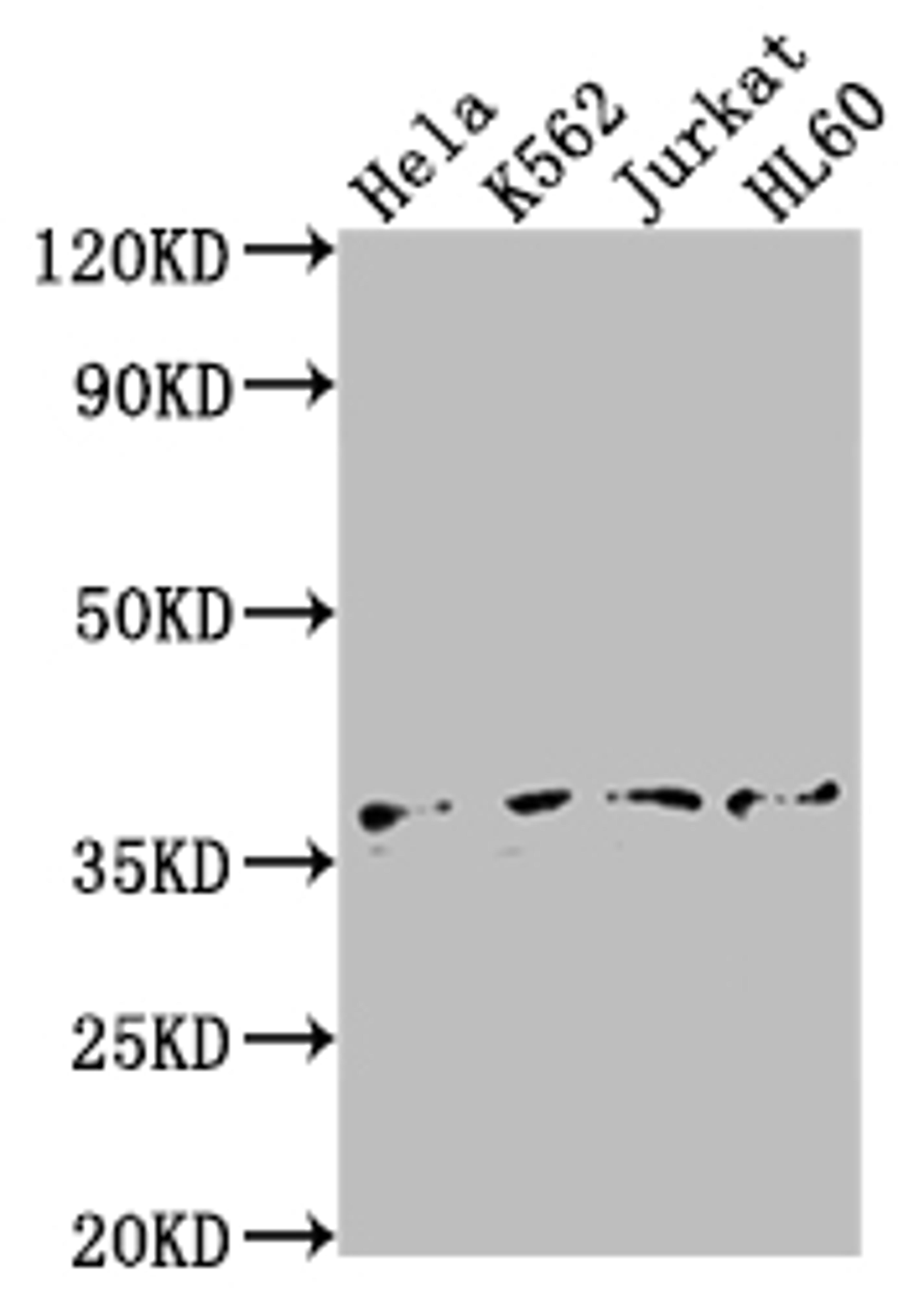 Western Blot. Positive WB detected in: Hela whole cell lysate, K562 whole cell lysate, Jurkat whole cell lysate, HL60 whole cell lysate. All lanes: TBP antibody at 1:2000. Secondary. Goat polyclonal to rabbit IgG at 1/50000 dilution. Predicted band size: 38, 36 kDa. Observed band size: 36 kDa. 