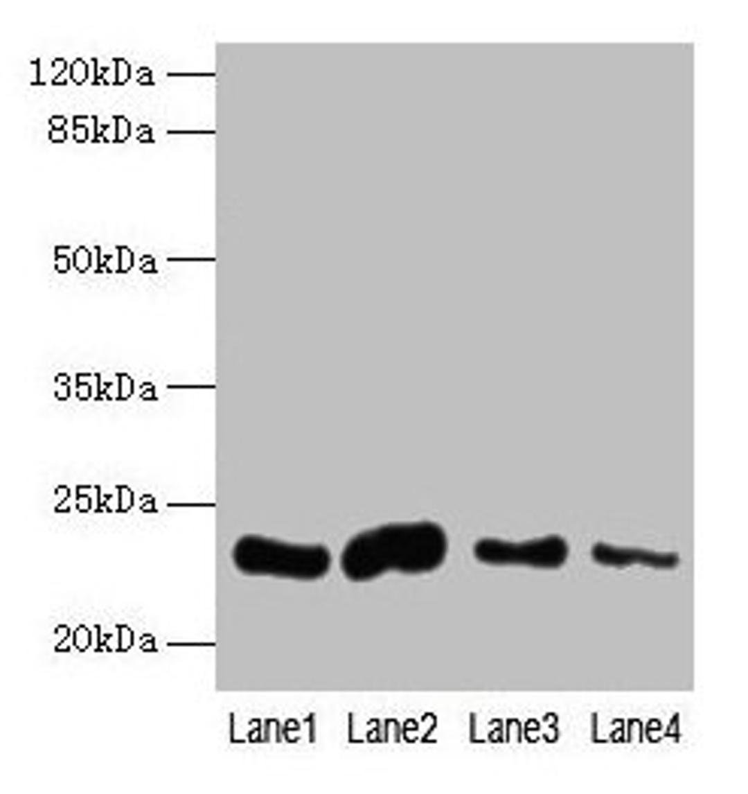 Western blot. All lanes: CLEC3A antibody at 0.4µg/ml. Lane 1: Mouse liver tissue. Lane 2: Mouse kidney tissue. Lane 3: Mouse brain tissue. Lane 4: Mouse lung tissue. Secondary. Goat polyclonal to rabbit IgG at 1/10000 dilution. Predicted band size: 23 kDa. Observed band size: 23 kDa
