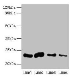 Western blot. All lanes: CLEC3A antibody at 0.4µg/ml. Lane 1: Mouse liver tissue. Lane 2: Mouse kidney tissue. Lane 3: Mouse brain tissue. Lane 4: Mouse lung tissue. Secondary. Goat polyclonal to rabbit IgG at 1/10000 dilution. Predicted band size: 23 kDa. Observed band size: 23 kDa