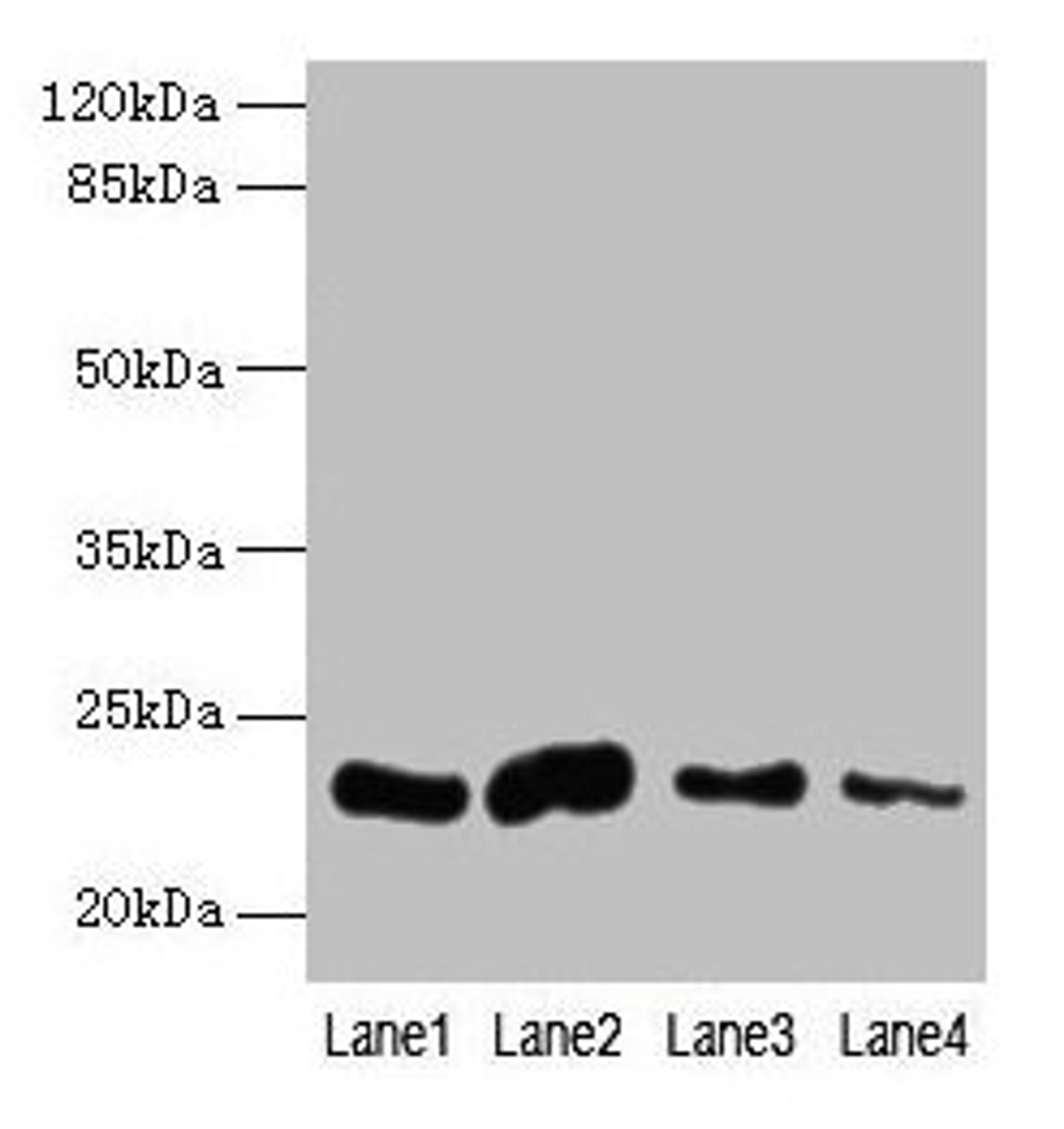 Western blot. All lanes: CLEC3A antibody at 0.4µg/ml. Lane 1: Mouse liver tissue. Lane 2: Mouse kidney tissue. Lane 3: Mouse brain tissue. Lane 4: Mouse lung tissue. Secondary. Goat polyclonal to rabbit IgG at 1/10000 dilution. Predicted band size: 23 kDa. Observed band size: 23 kDa