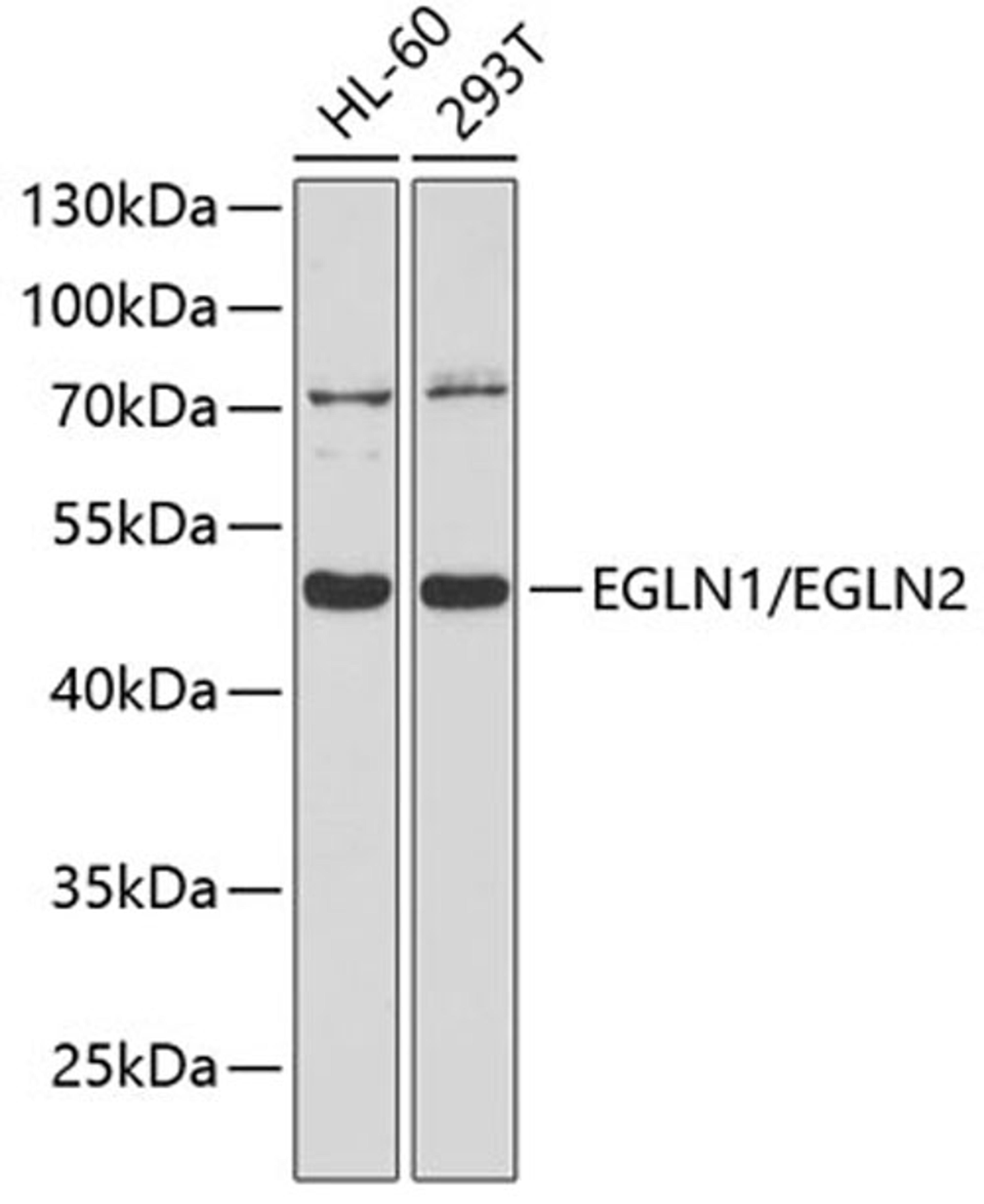 Western blot - EGLN1/EGLN2 antibody (A10342)