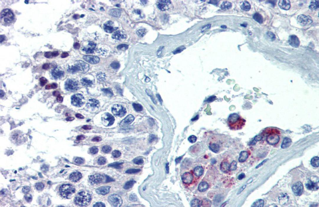 Antibody used in IHC on Human Testis at 5.0 ug/ml.