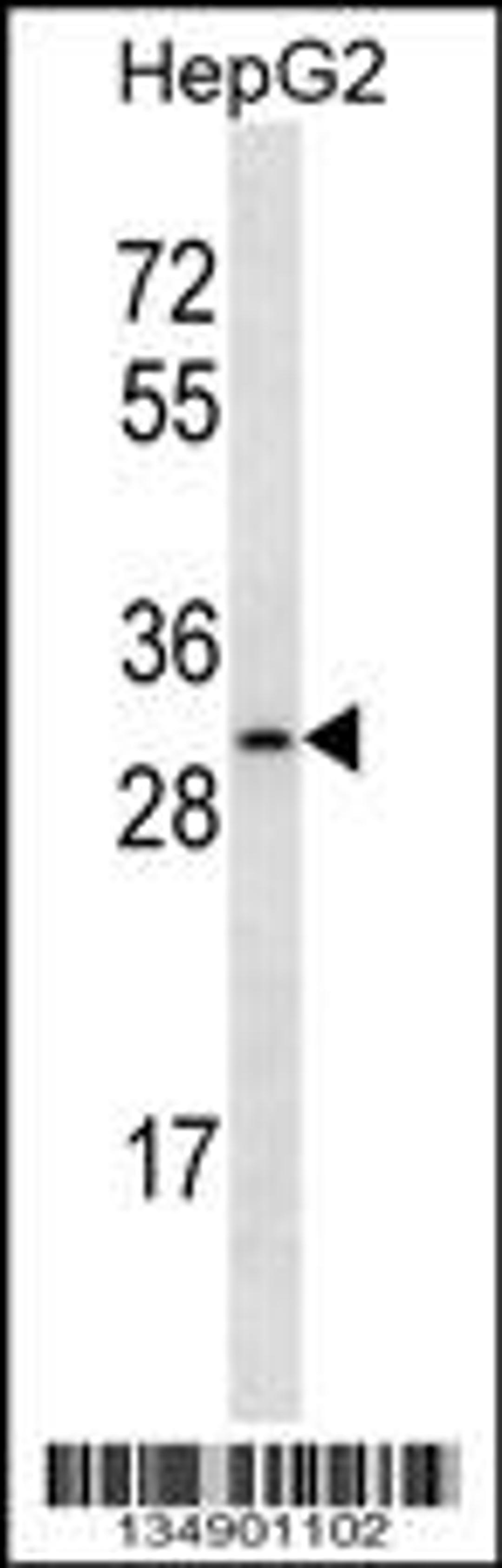 Western blot analysis in HepG2 cell line lysates (35ug/lane).