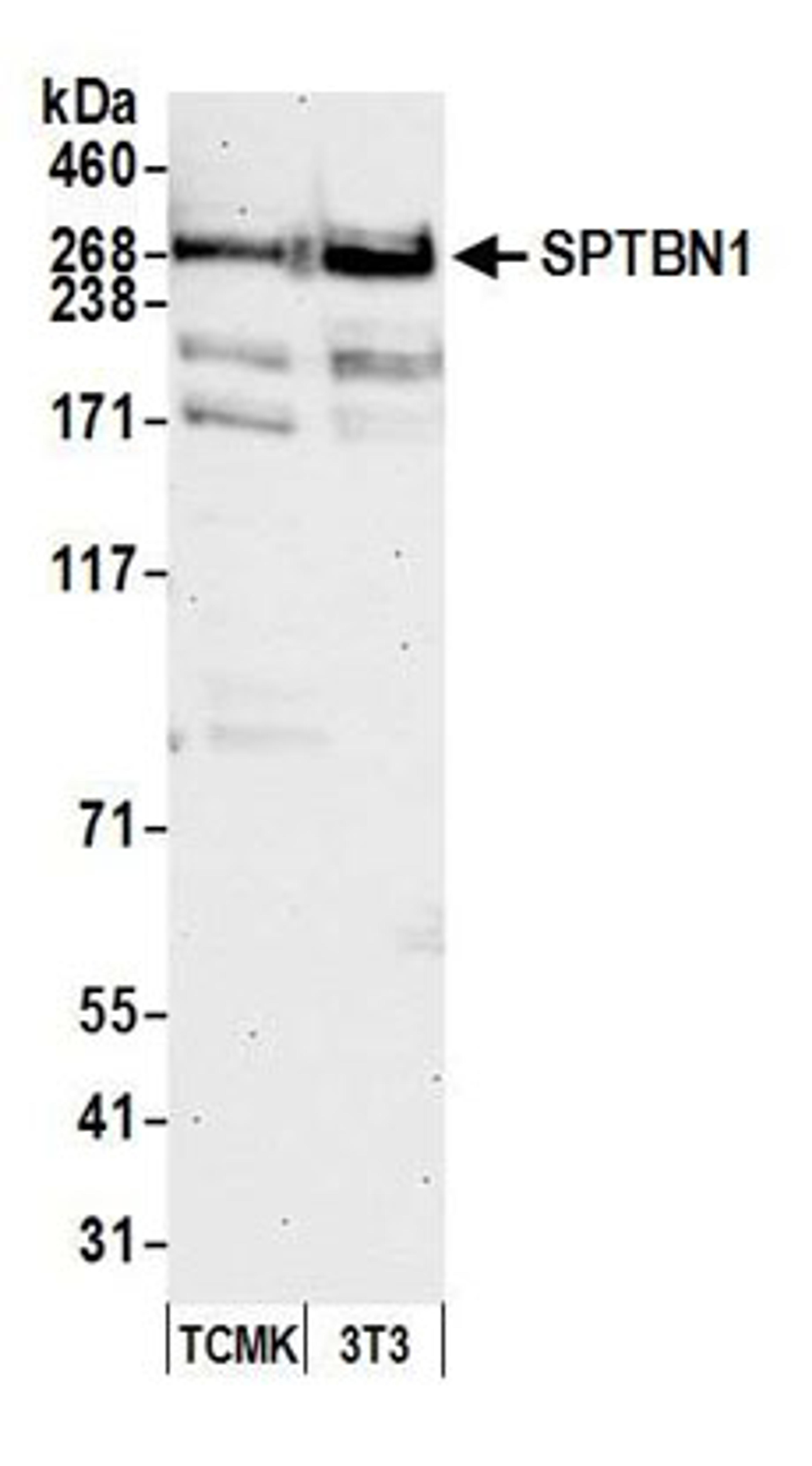 Detection of mouse SPTBN1 by western blot.