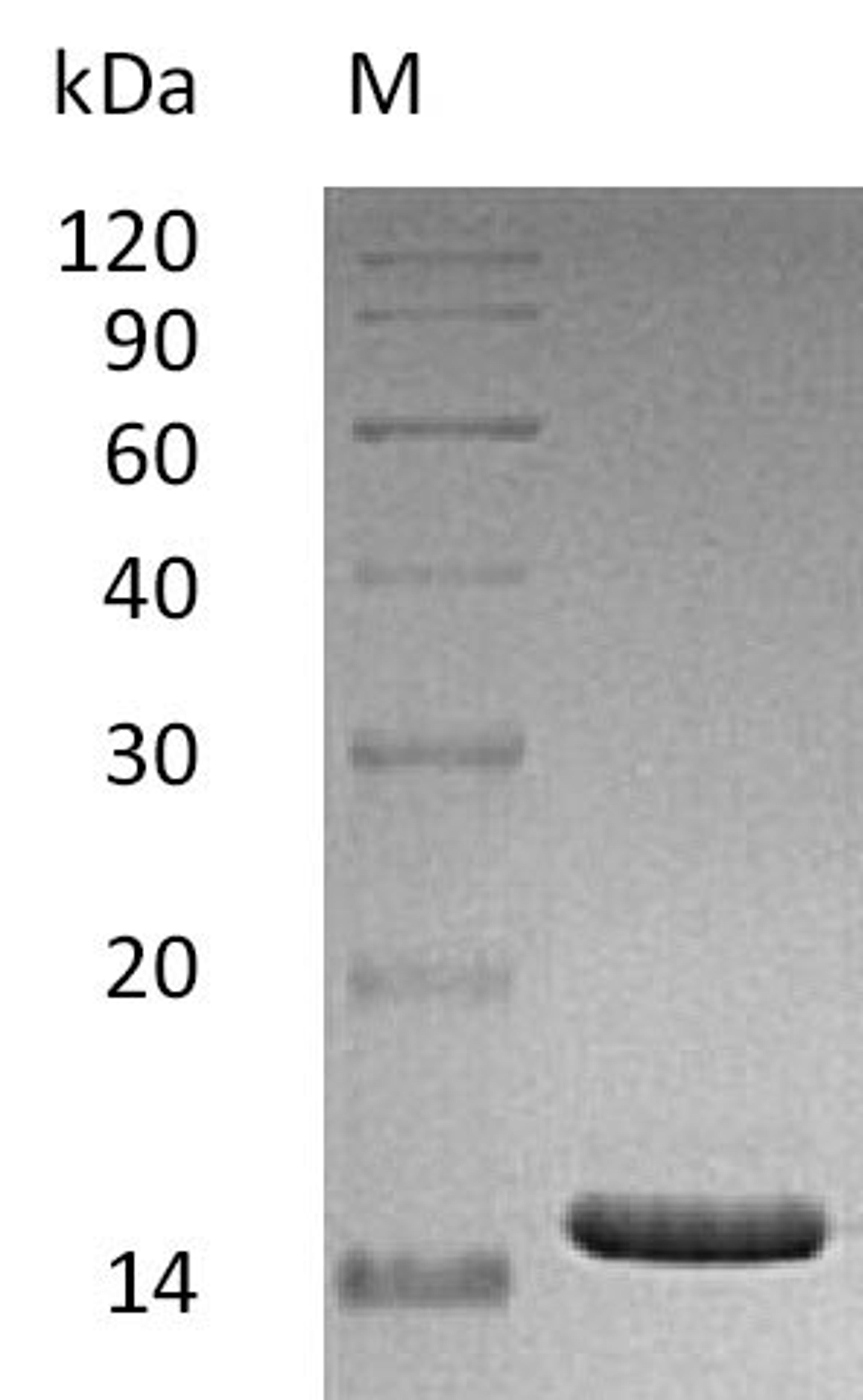 (Tris-Glycine gel) Discontinuous SDS-PAGE (reduced) with 5% enrichment gel and 15% separation gel.