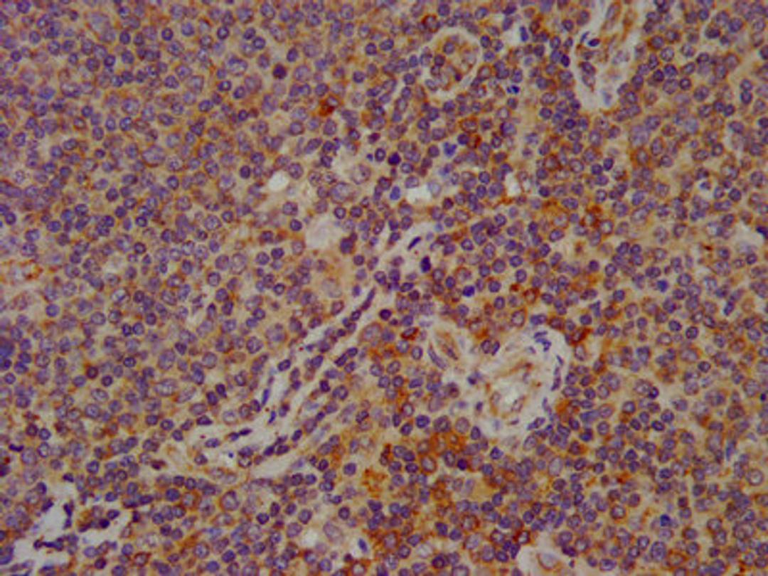 IHC image of CSB-PA008279LA01HU diluted at 1:600 and staining in paraffin-embedded human lymph node tissue performed on a Leica BondTM system. After dewaxing and hydration, antigen retrieval was mediated by high pressure in a citrate buffer (pH 6.0). Section was blocked with 10% normal goat serum 30min at RT. Then primary antibody (1% BSA) was incubated at 4°C overnight. The primary is detected by a biotinylated secondary antibody and visualized using an HRP conjugated SP system.