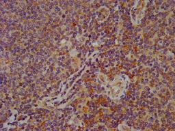 IHC image of CSB-PA008279LA01HU diluted at 1:600 and staining in paraffin-embedded human lymph node tissue performed on a Leica BondTM system. After dewaxing and hydration, antigen retrieval was mediated by high pressure in a citrate buffer (pH 6.0). Section was blocked with 10% normal goat serum 30min at RT. Then primary antibody (1% BSA) was incubated at 4°C overnight. The primary is detected by a biotinylated secondary antibody and visualized using an HRP conjugated SP system.