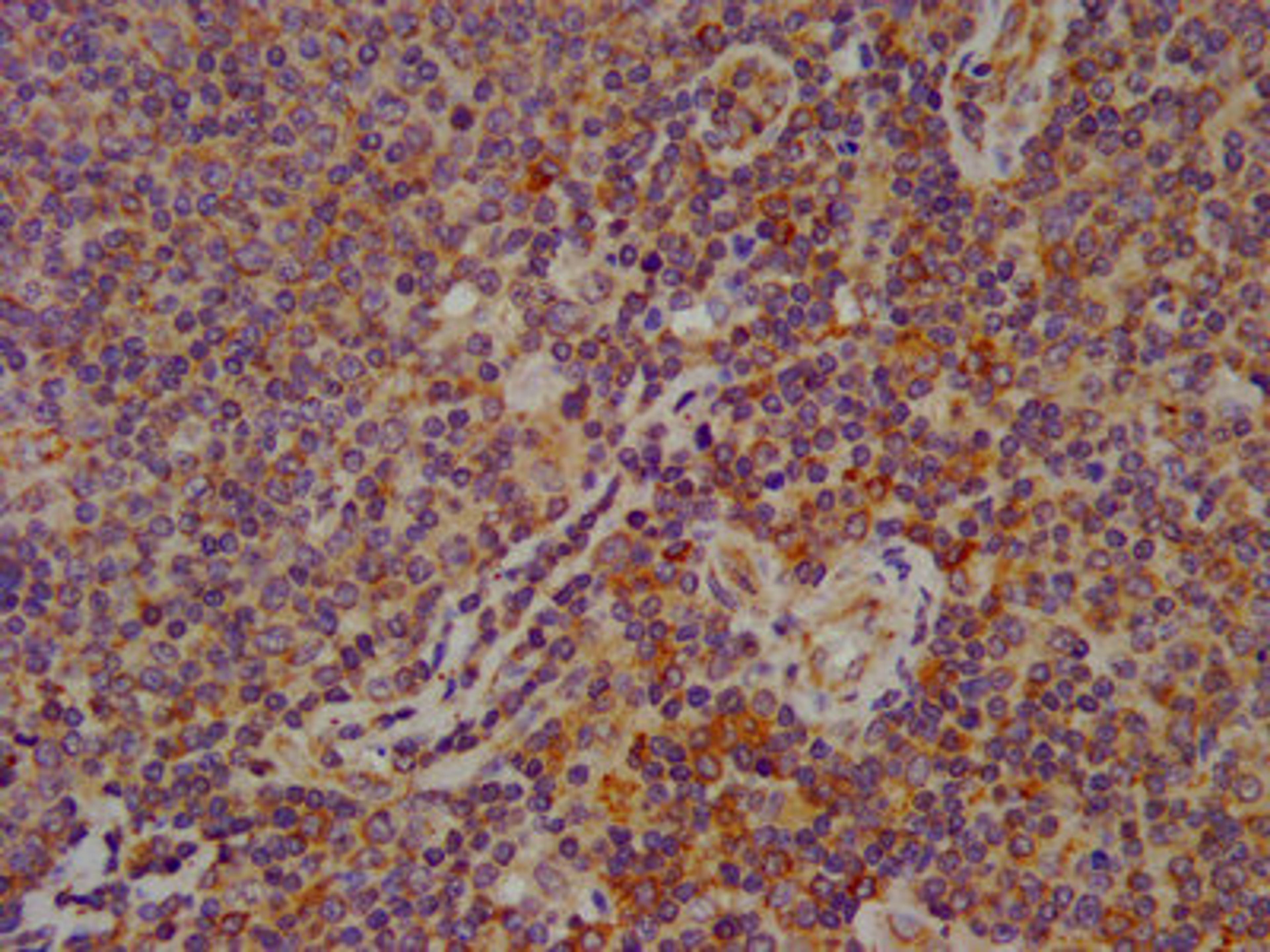 IHC image of CSB-PA008279LA01HU diluted at 1:600 and staining in paraffin-embedded human lymph node tissue performed on a Leica BondTM system. After dewaxing and hydration, antigen retrieval was mediated by high pressure in a citrate buffer (pH 6.0). Section was blocked with 10% normal goat serum 30min at RT. Then primary antibody (1% BSA) was incubated at 4°C overnight. The primary is detected by a biotinylated secondary antibody and visualized using an HRP conjugated SP system.