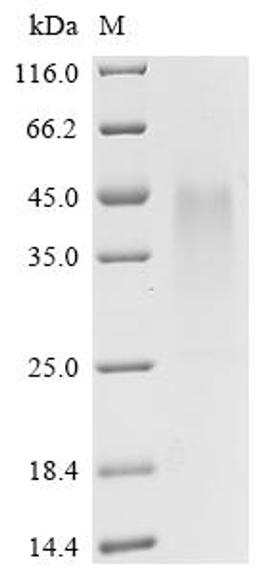 (Tris-Glycine gel) Discontinuous SDS-PAGE (reduced) with 5% enrichment gel and 15% separation gel.