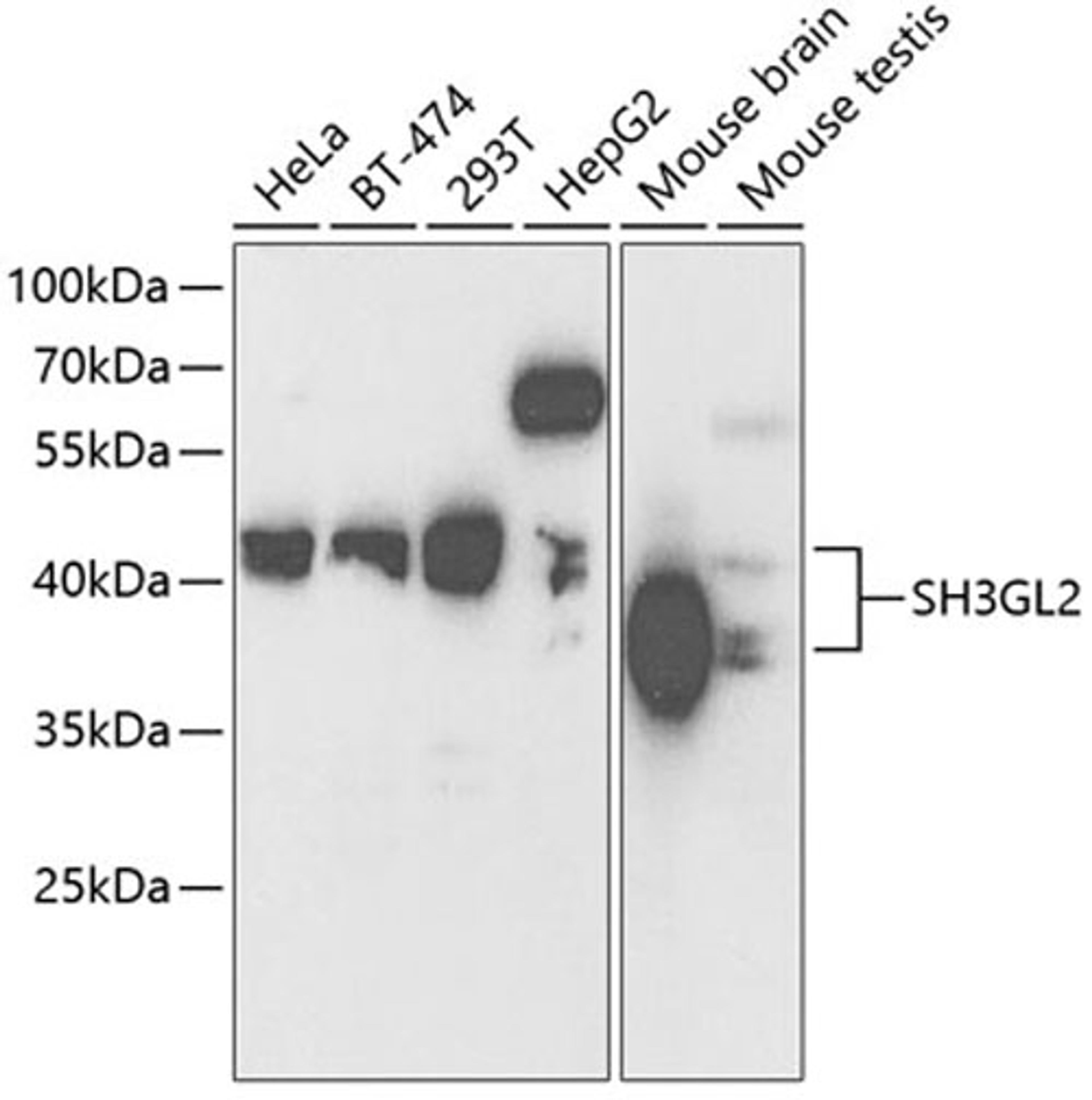 Western blot - SH3GL2 antibody (A5701)