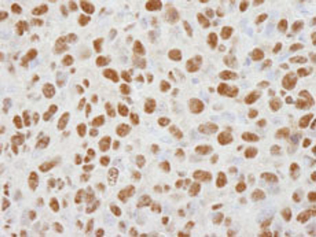 Detection of mouse HDAC1 by immunohistochemistry.