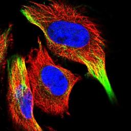 Immunocytochemistry/Immunofluorescence: ARHGEF38 Antibody [NBP1-93985] - Staining of human cell line U-251 MG shows positivity in cytoskeleton (intermediate filaments).