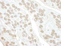 Detection of human POLR3D by immunohistochemistry.