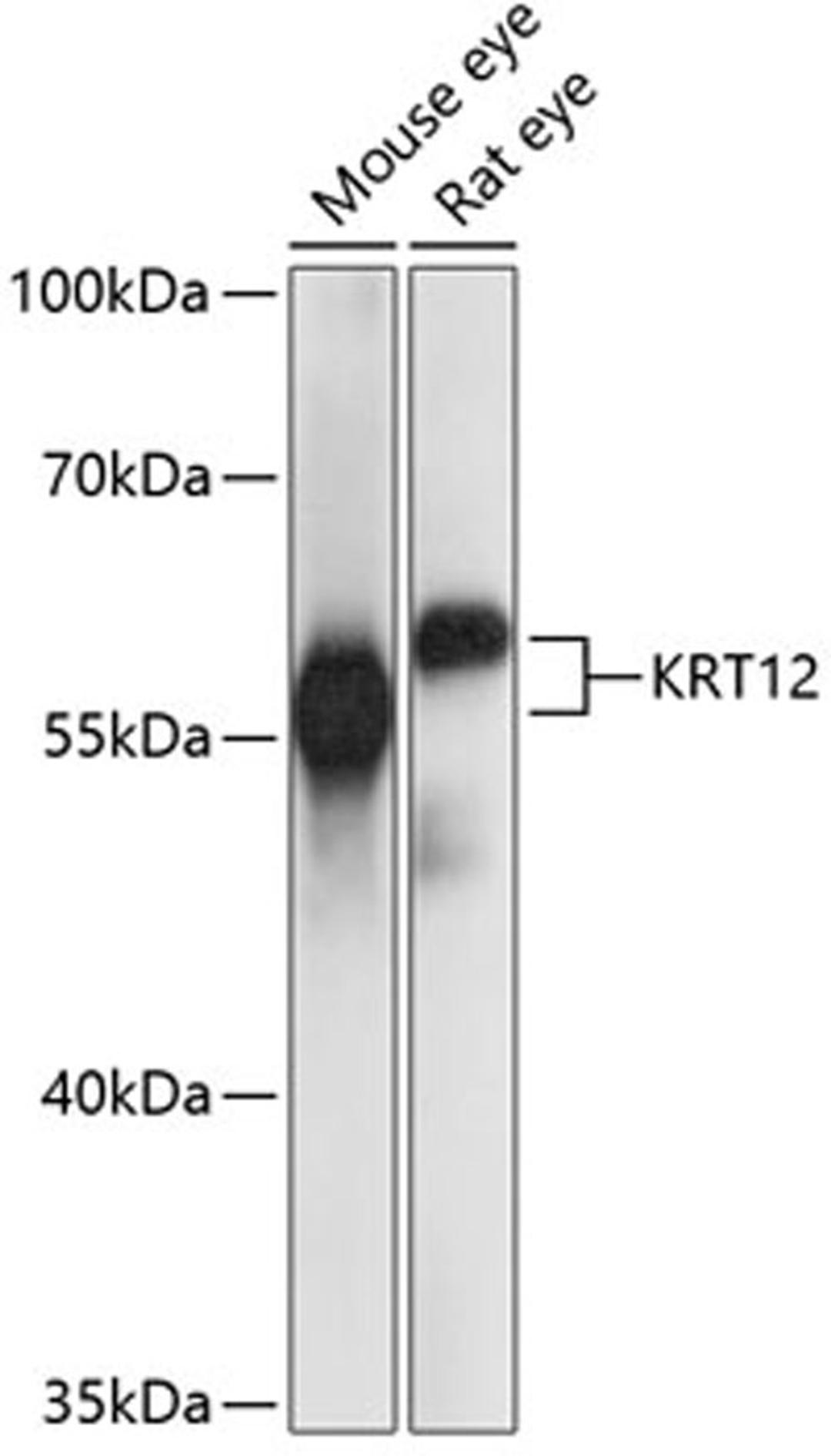 Western blot - KRT12 antibody (A14746)