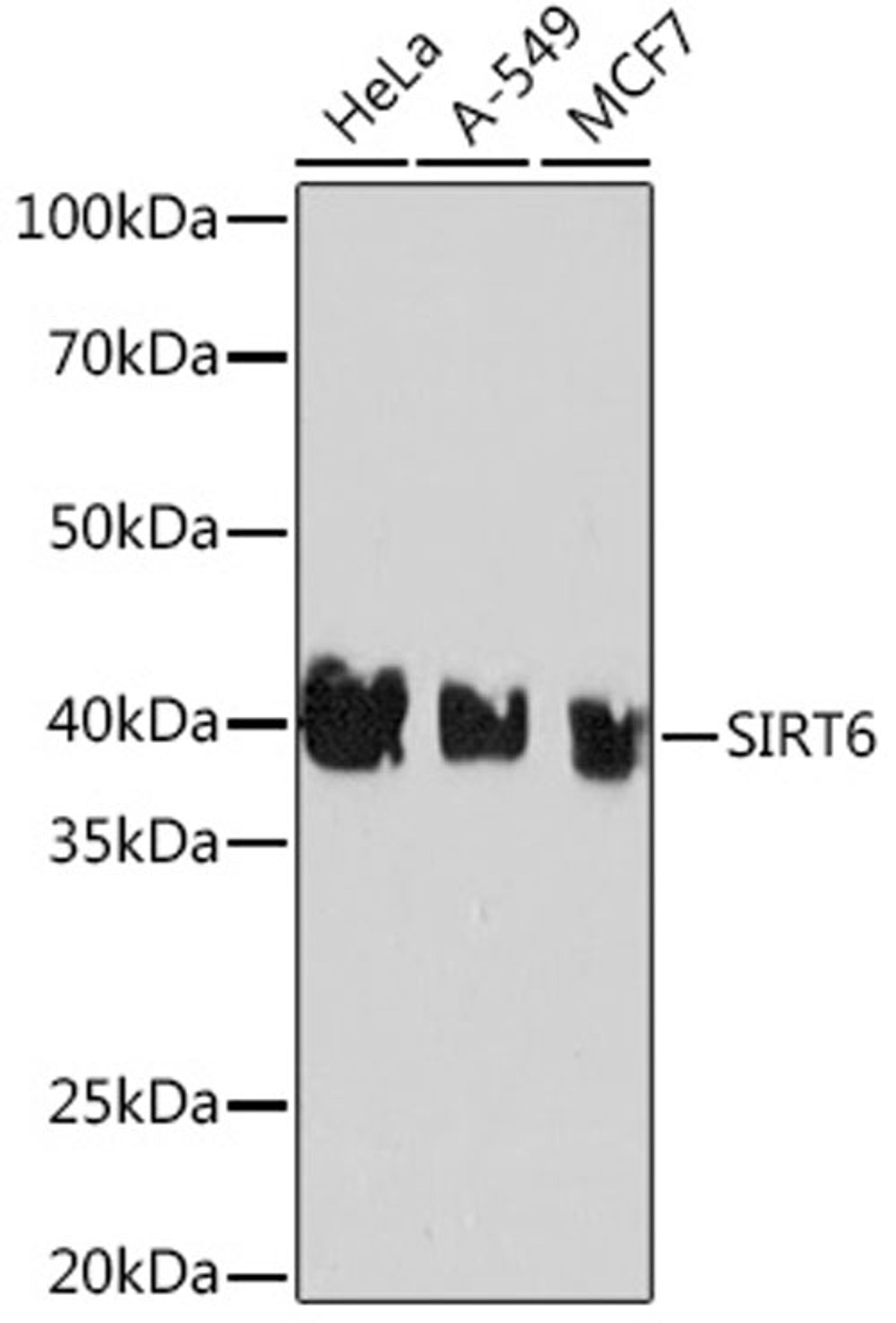 Western blot - SIRT6 Rabbit mAb (A3591)