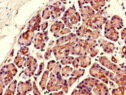 Immunohistochemistry of paraffin-embedded human pancreatic tissue using CSB-PA883432LA01HU at dilution of 1:100