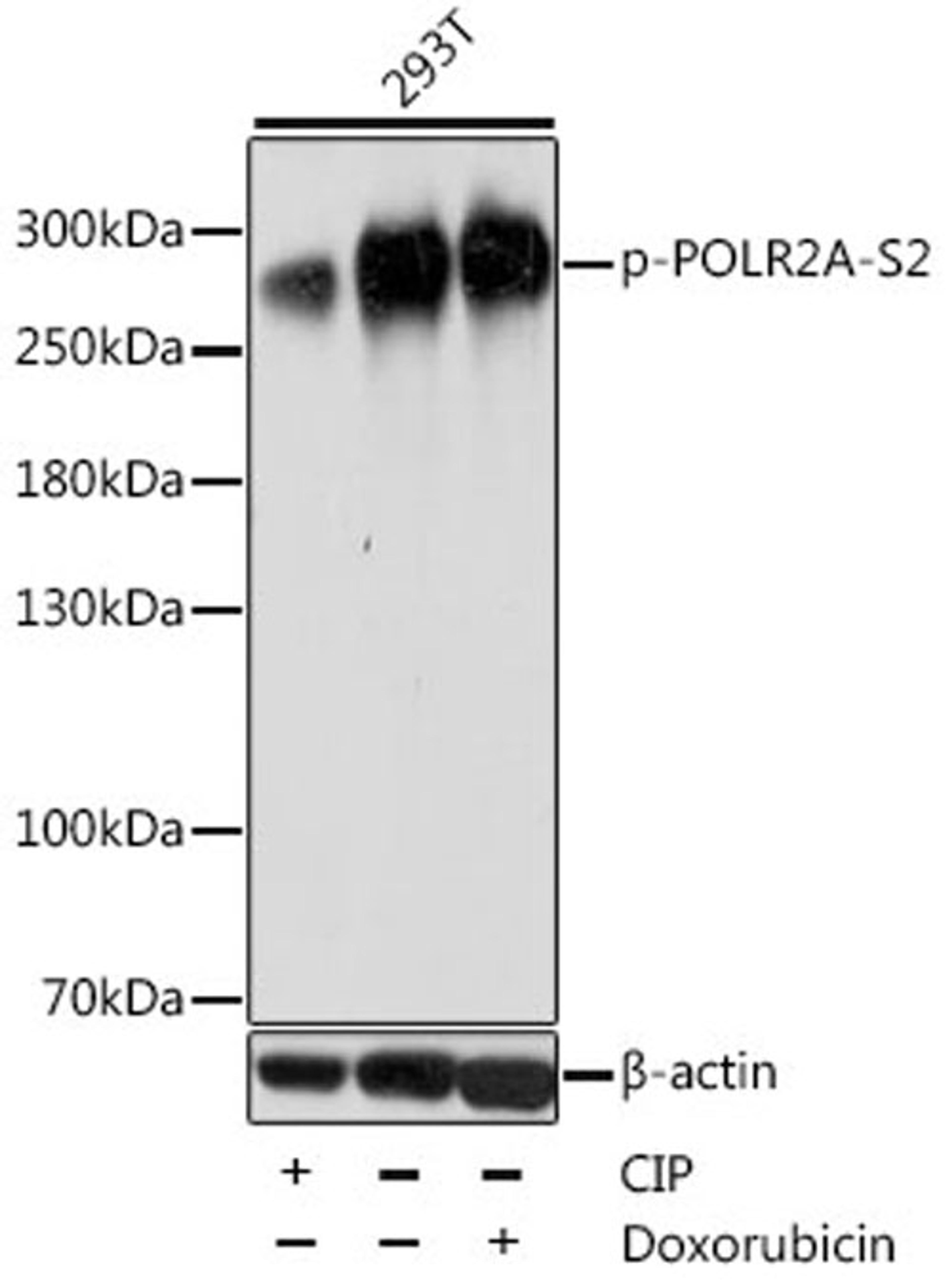 Western blot - Phospho-POLR2A-S2 antibody (AP0749)