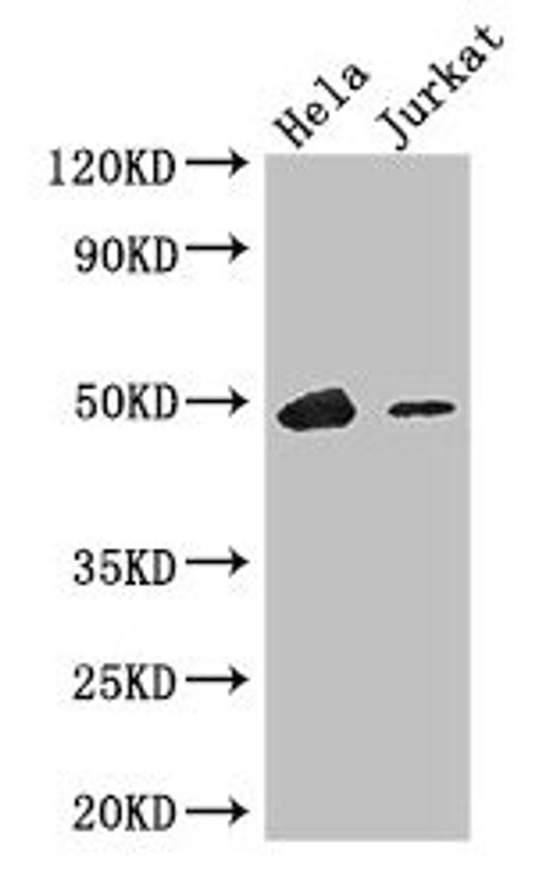 Western Blot. Positive WB detected in: Hela whole cell lysate, Jurkat whole cell lysate. All lanes: IKZF1 antibody at 3.4ug/ml. Secondary. Goat polyclonal to rabbit IgG at 1/50000 dilution. Predicted band size: 58, 49, 48, 44, 42, 32, 53, 25 kDa. Observed band size: 49 kDa.