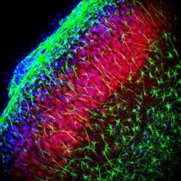 Immunocytochemistry/Immunofluorescence: TRPM2 Antibody [NB110-81601] - Staining of rat hippocampus using NB110-81601. TRPM2 is stained red, GFAP is stained green and nuclei staining is blue. Photo courtesy of Dr. Ji-Zhong Bai, The University of Auckland, New Zealand.