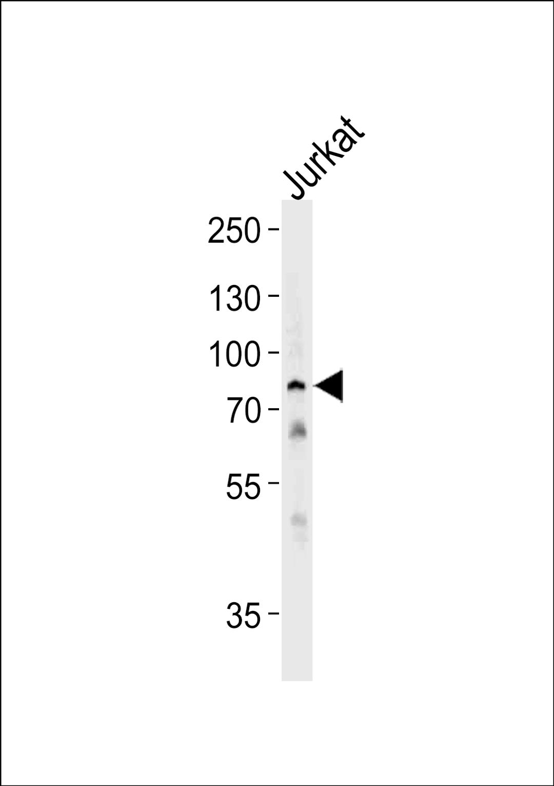 Western blot analysis of lysate from Jurkat cell line,using HSPA6 Antibody .AP8708b was diluted at 1:1000 at each lane