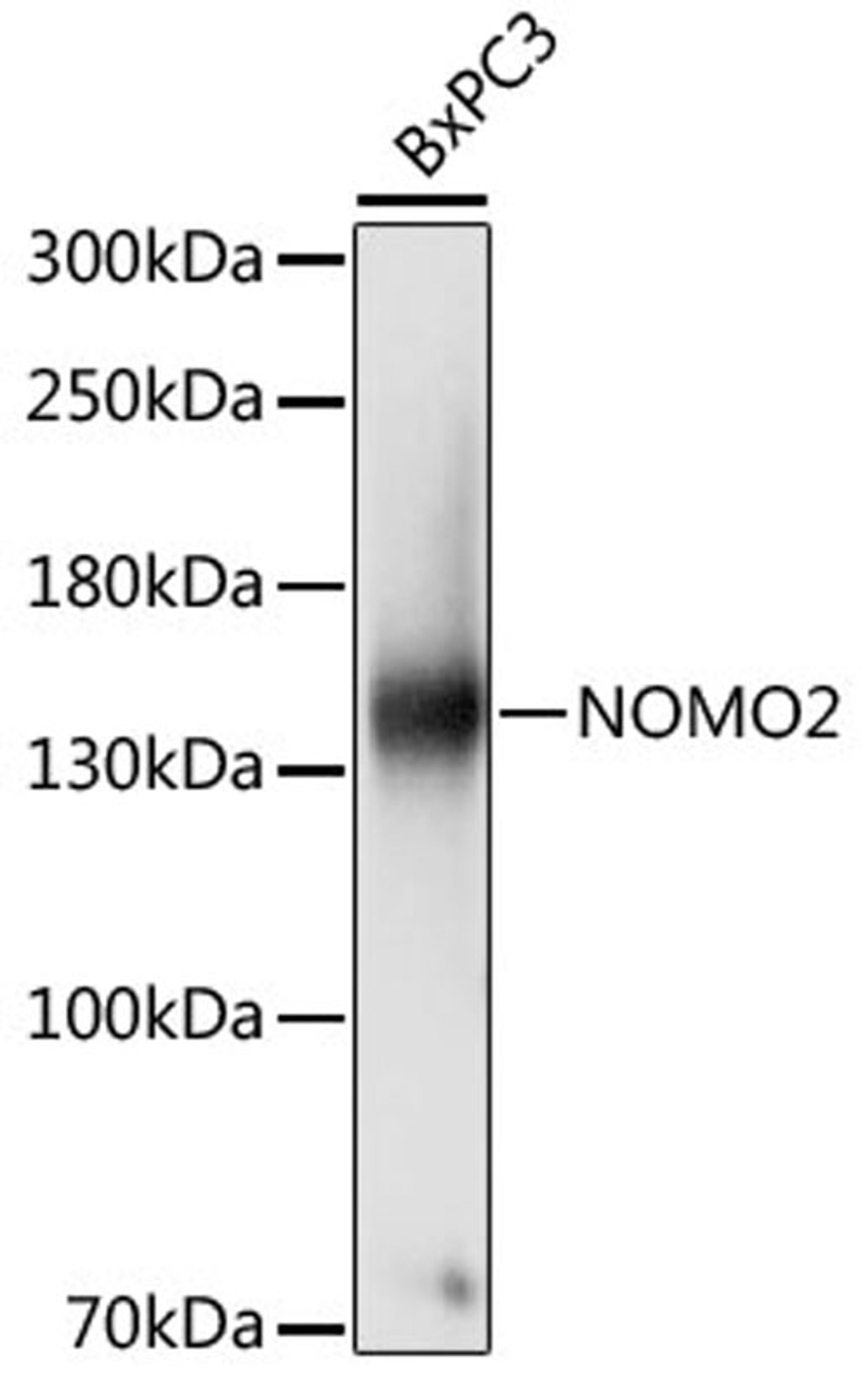 Western blot - NOMO2 antibody (A16614)