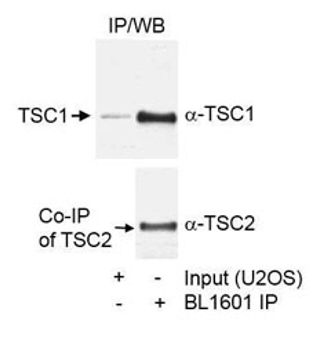 Detection of human TSC1 by western blot of immunoprecipitates.