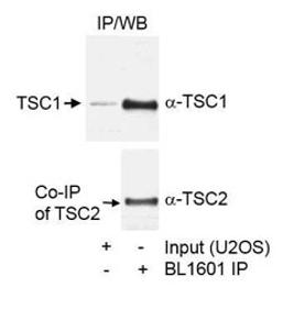 Detection of human TSC1 by western blot of immunoprecipitates.