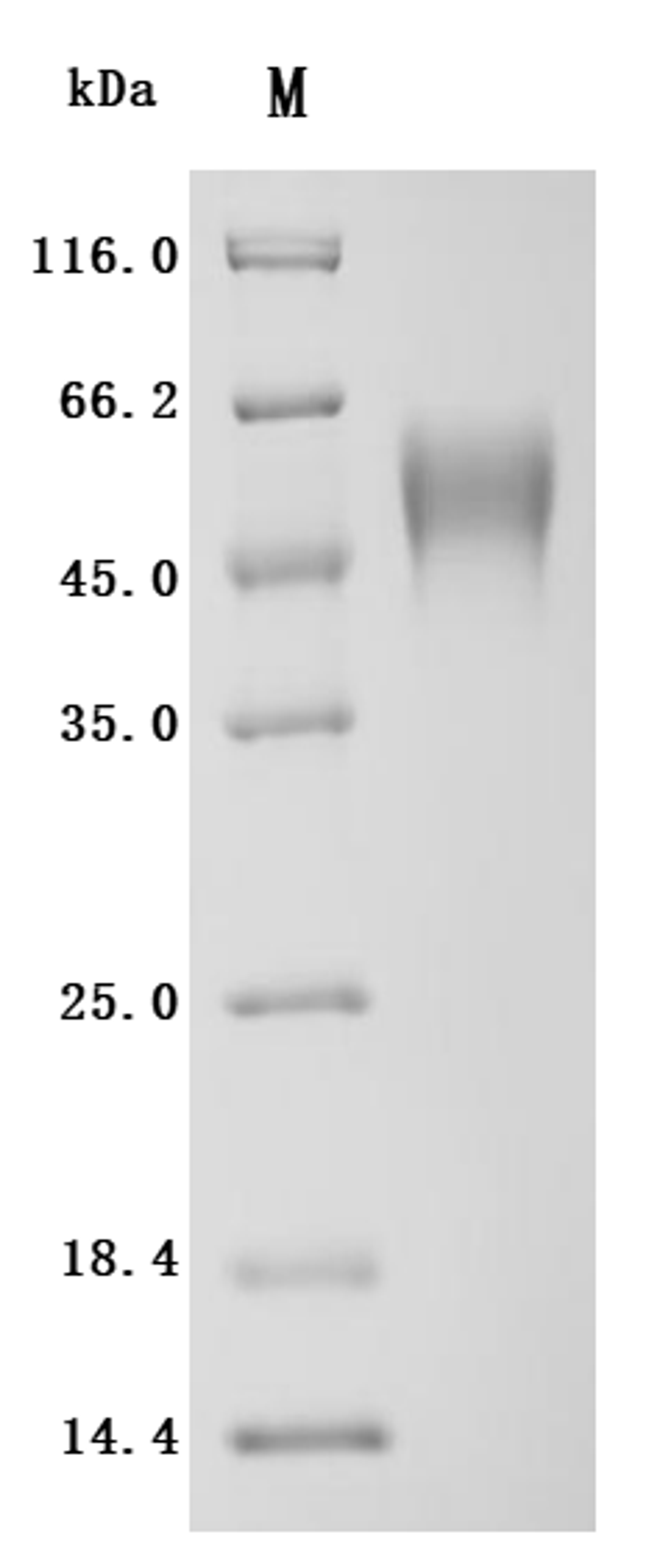 (Tris-Glycine gel) Discontinuous SDS-PAGE (reduced) with 5% enrichment gel and 15% separation gel.