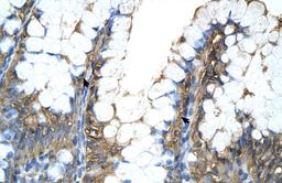 Antibody used in IHC on Human Intestine.