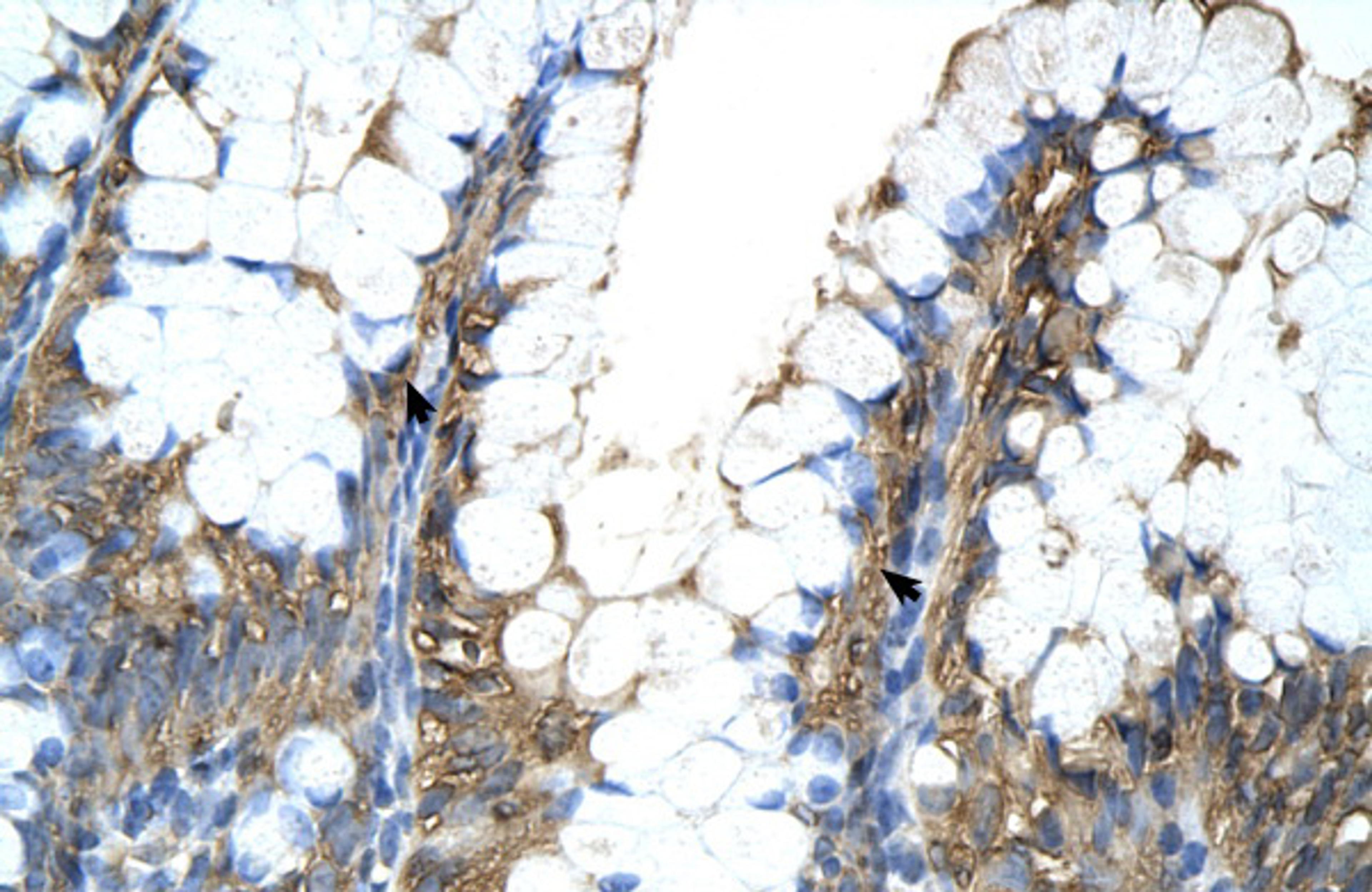 Antibody used in IHC on Human Intestine.